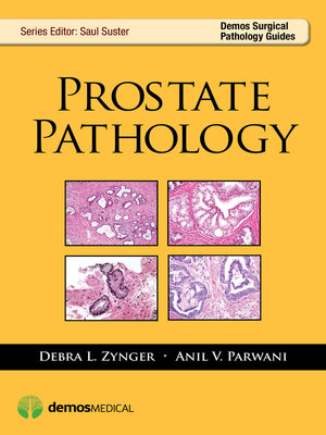cover image of Prostate Pathology